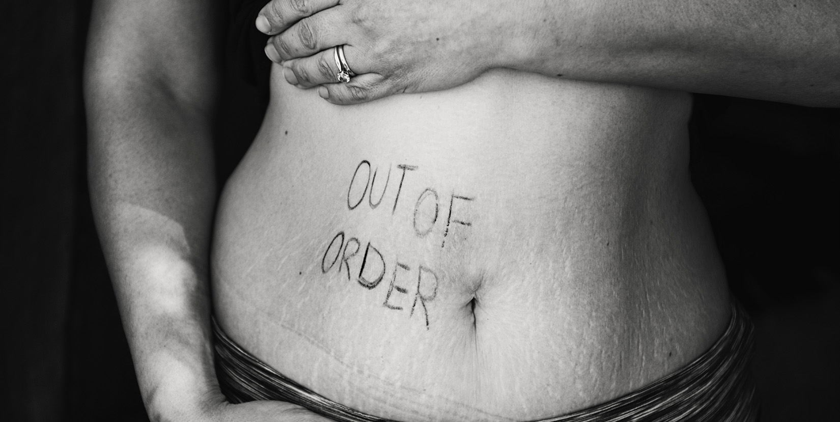 leaky gut